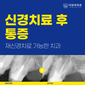 호평동치과