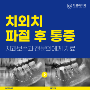 호평동치과
