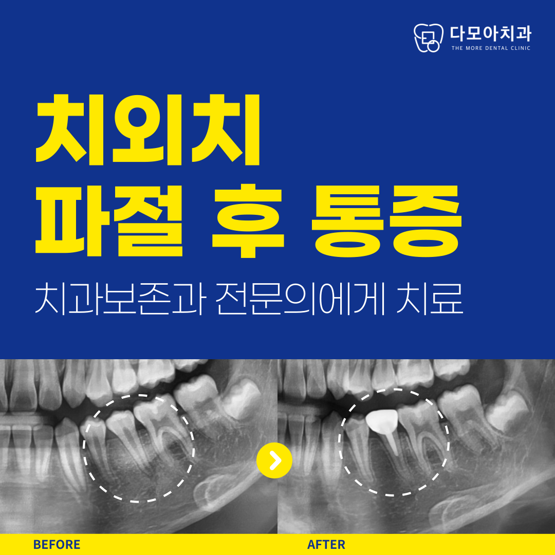 호평동치과