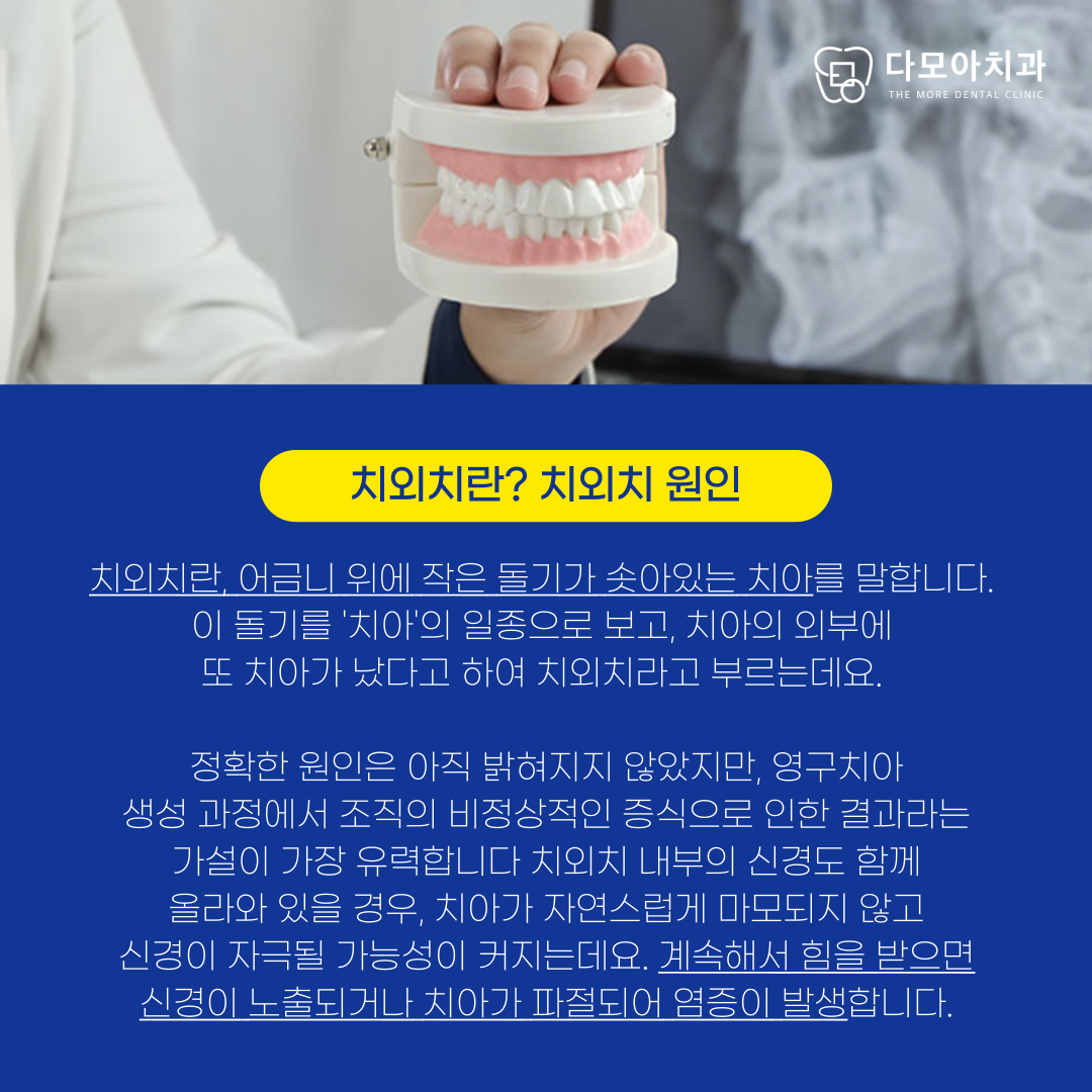 호평동치과