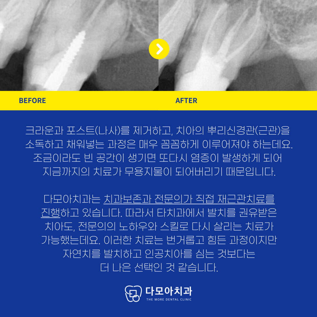 호평동치과