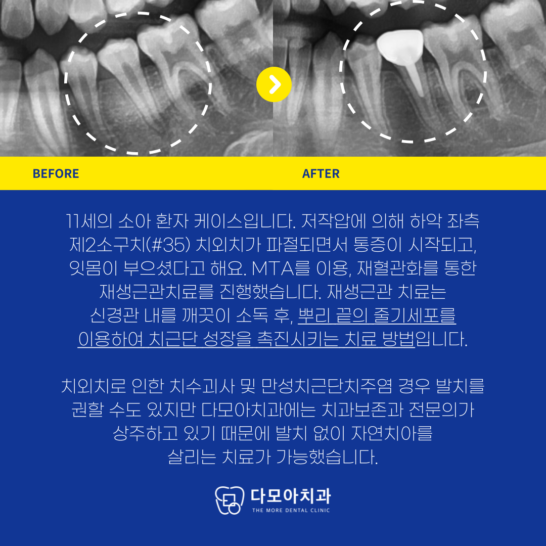 호평동치과