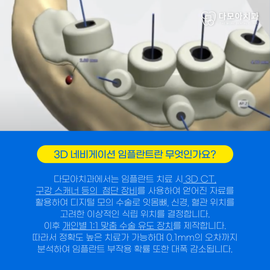 다산동치과
