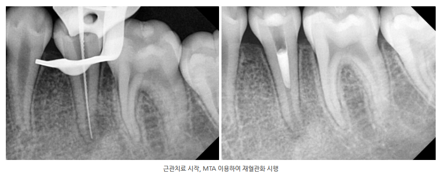 호평동치과