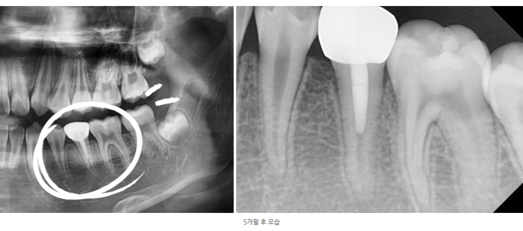 호평동치과