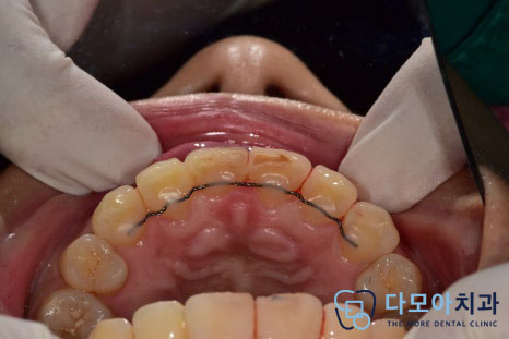다산동치과