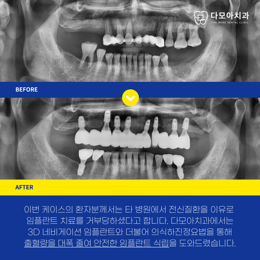 호평치과
