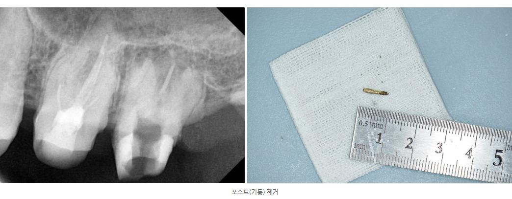 호평동치과
