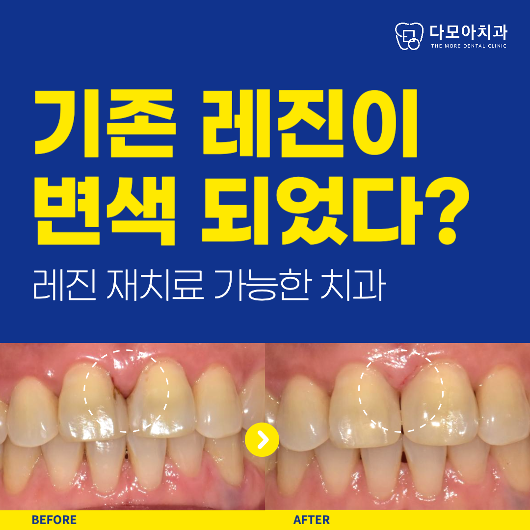 호평동치과