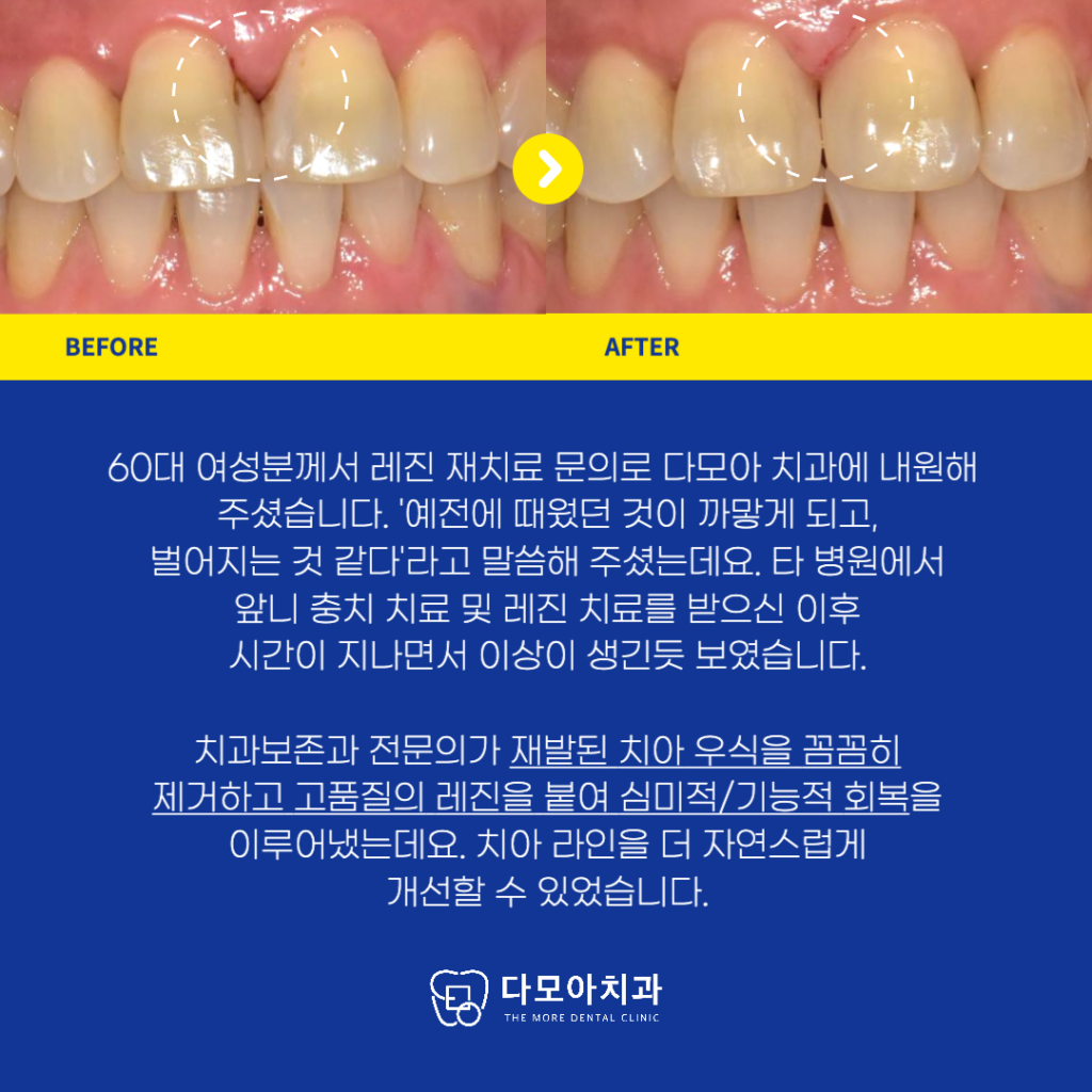 호평동치과