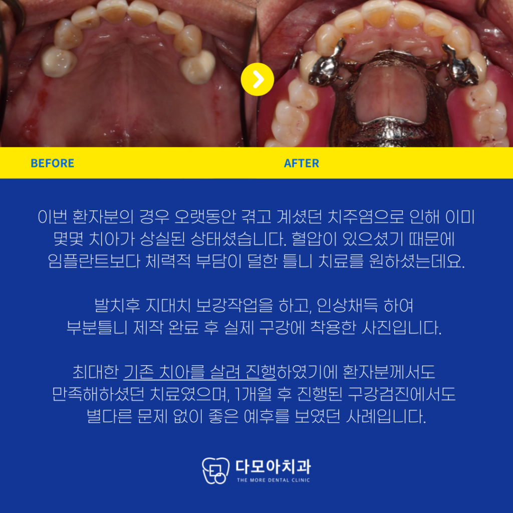 호평동치과