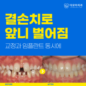 다산동치과