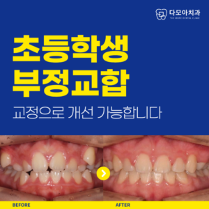 초등학생_교정