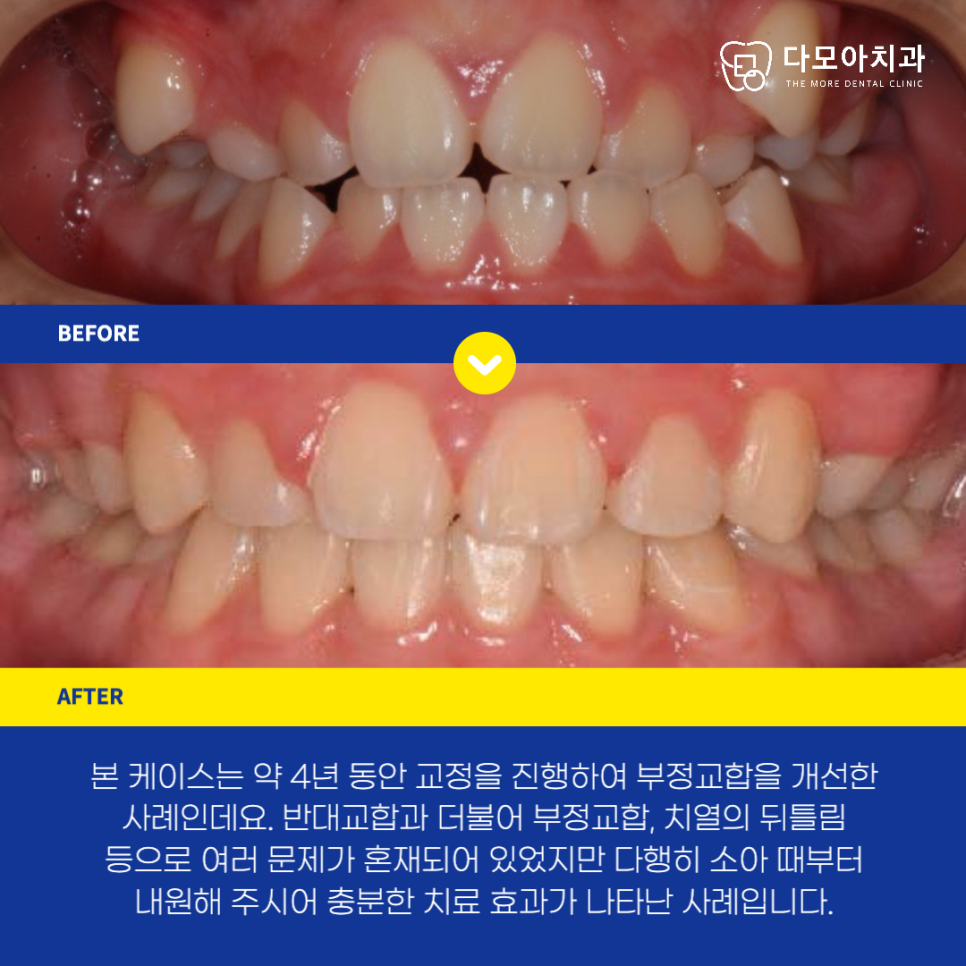호평동치과