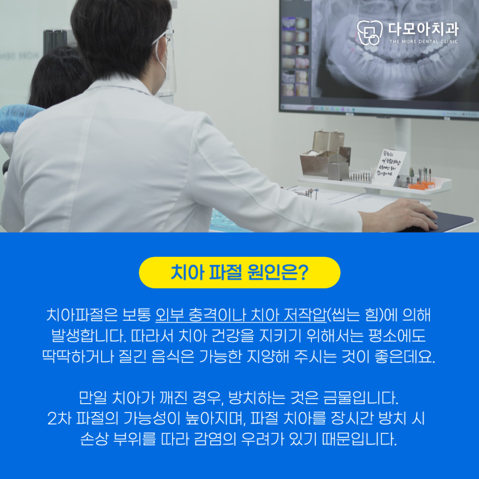 다산동치과앞니레진치료후기