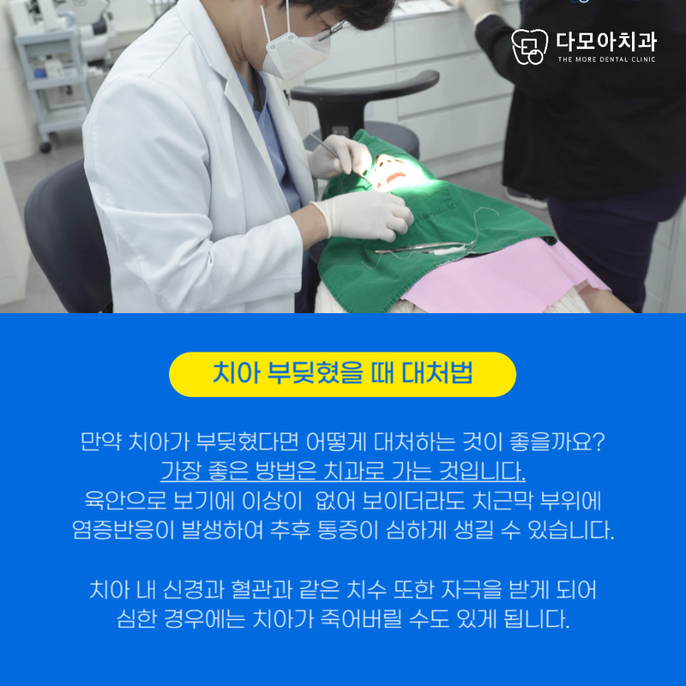 앞니안쪽들어감치과치료