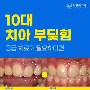 도농역앞니응급치료가능