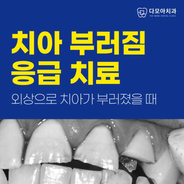 호평동치과