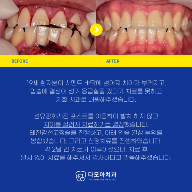 호평동치과