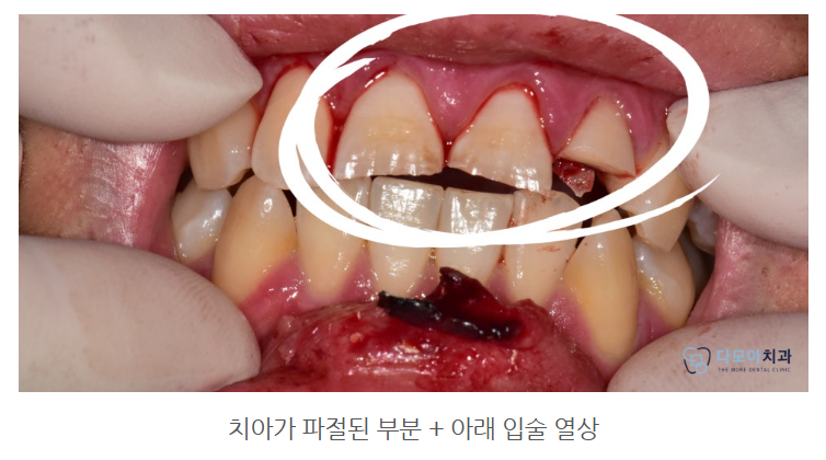 호평동치과