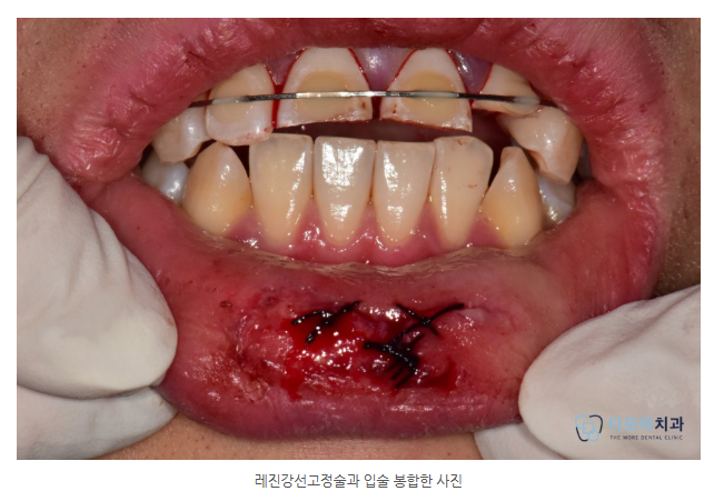 호평동치과